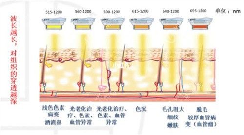 M22光子嫩膚不同波長