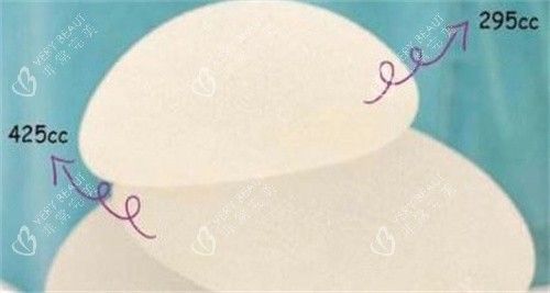 不同的假體規(guī)格