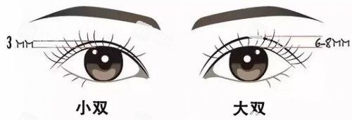 双眼皮宽度示意图