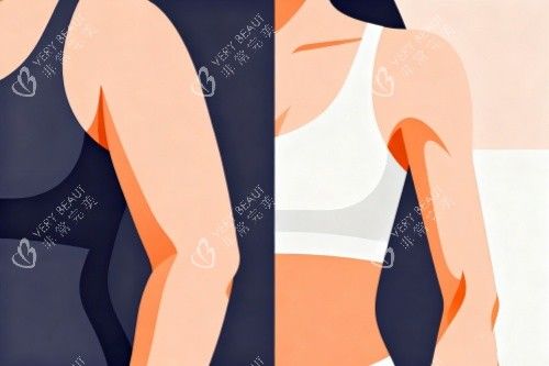 胳膊做吸脂卡通图