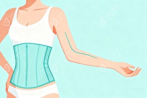 腰腹部做吸脂展示图