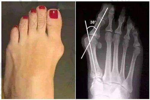 今喜医美整体吸脂价格参考是怎样的?