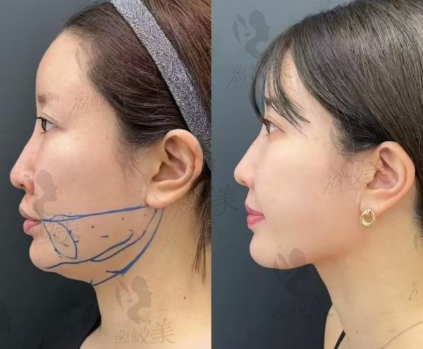 深圳今喜医疗医生团队实力如何?