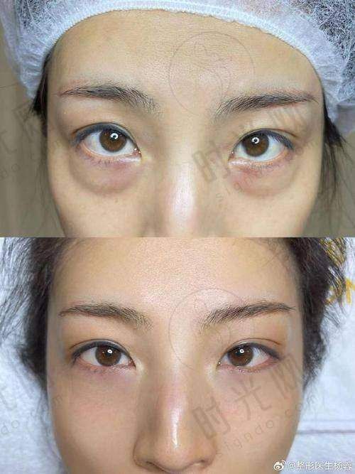 广州荔医整形美容价格表