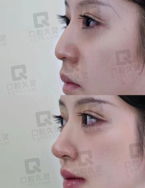 深圳曹孟君医生:专注40年的形体雕塑骨干医生