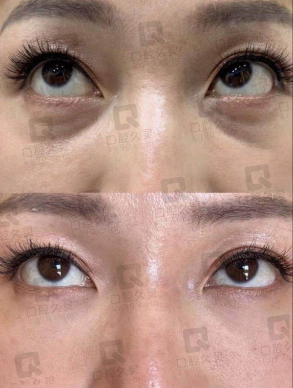 深圳曹孟君所在医院情况