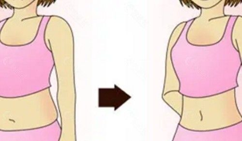 连云港医大整形医院吸脂怎么样