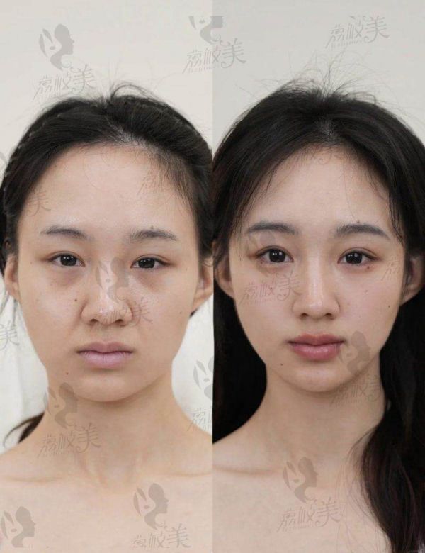 深圳今喜医疗：医院实力与口碑怎样？