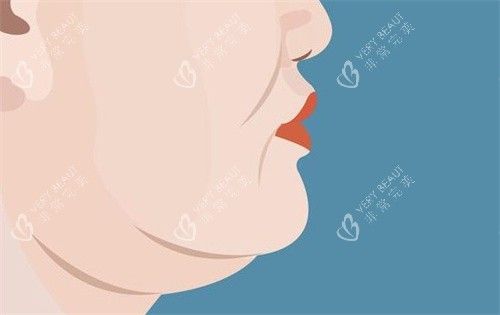 双下巴的样子卡通图