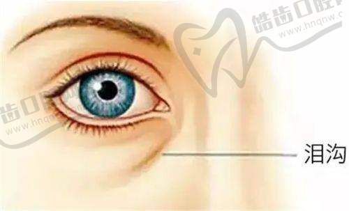 李增辉医生的吸脂技术有哪些特点?