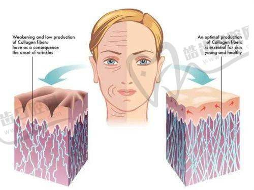 李增辉医生吸脂术后成效和价格如何?