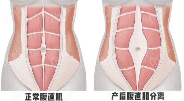 刘宾医生腹壁成功实例更是惊艳到你