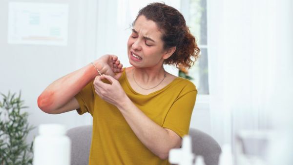 出现食物过敏的症状