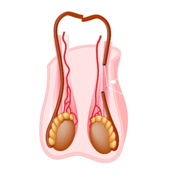 阴囊皮疼什么原因