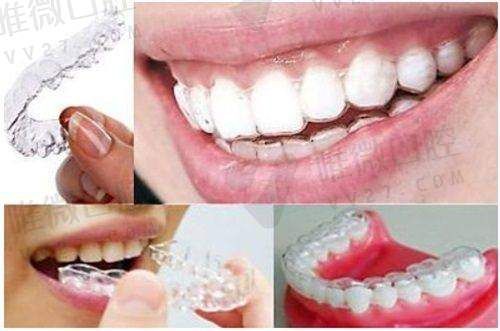 五、大同市第一人民医院口腔科常见问题及就诊指南