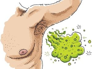 白醋和花椒去狐臭配方