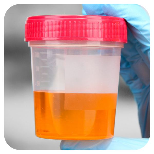 如何根据尿尿颜色分辨健康状况