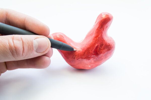 胃癌患者能吃紅果嗎