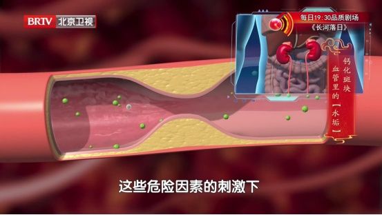 高血压吃这4种食物，相当于给脑梗“递刀子”，最好一口都别沾