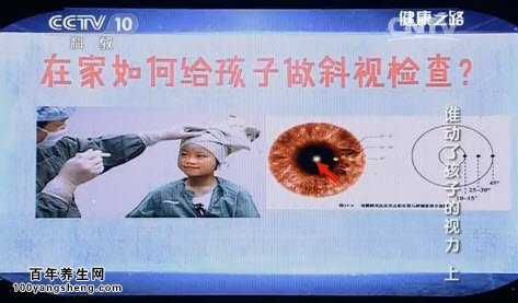 斜視如何及早發(fā)現(xiàn)