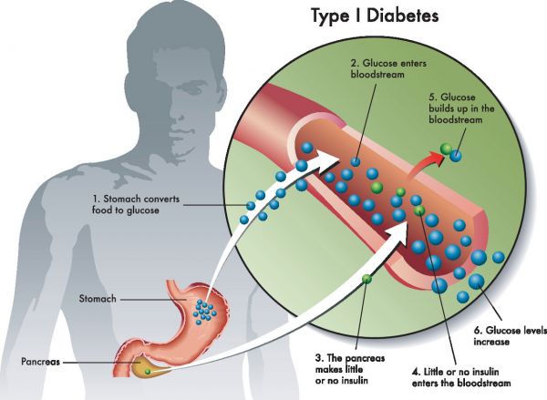 梧州治糖尿病医院哪家比较好