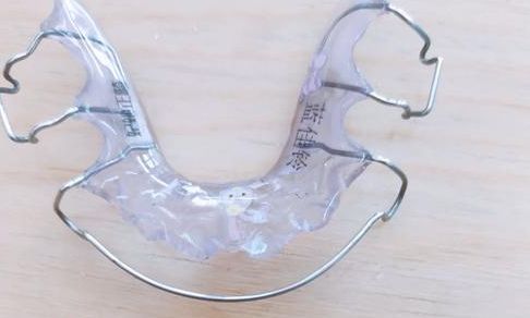 一、需要做牙齿间隙保持器的情况