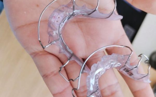 二、不需要做牙齿间隙保持器的情况