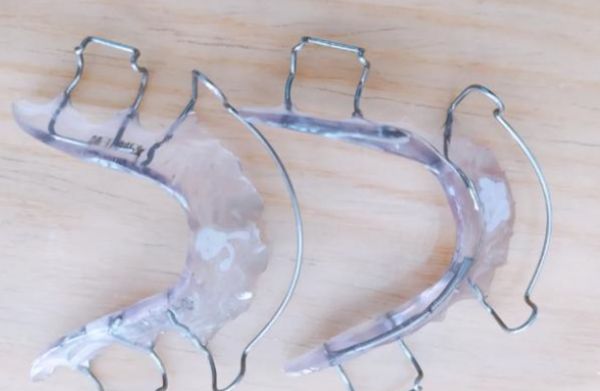 三、牙齿间隙保持器优点与局限