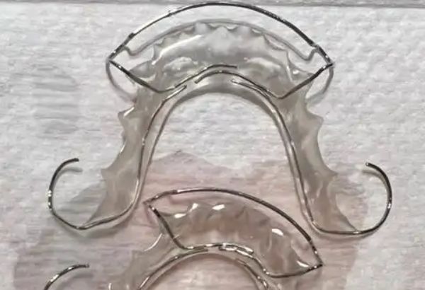 四、牙齿间隙保持器风险与禁忌www.59w.net