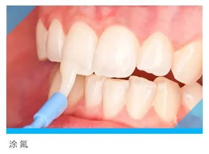 关爱儿童牙齿：从 0 岁到 6 岁的儿牙护理大全，赶紧收藏分享吧～