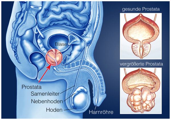 睾丸增大的方法有哪些