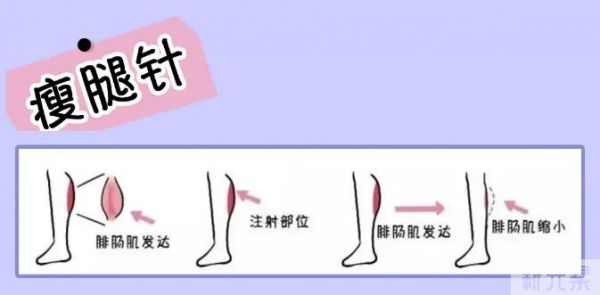 这款既能瘦脸、瘦腿，又能控油、除皱的轻医美真的绝! 图片-4