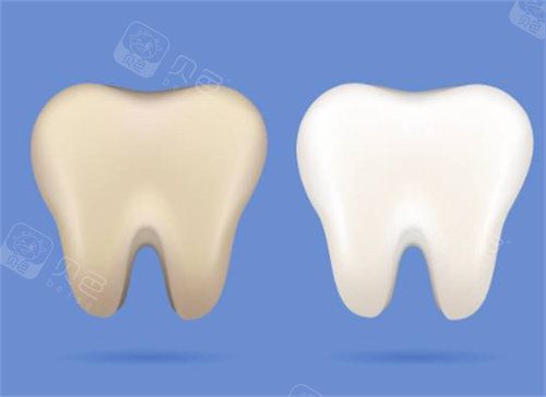 牙齿美白前后图