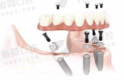 长沙雅贝康口腔挂号攻略