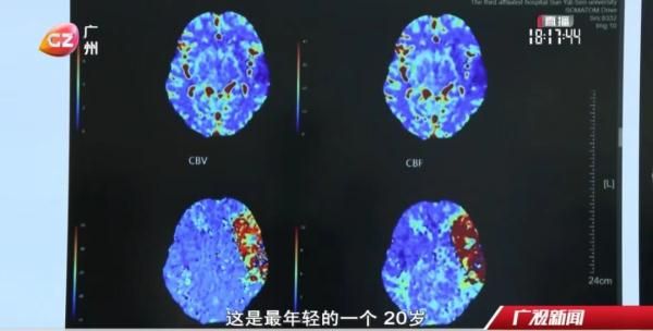 20岁小伙突然被确诊！提醒：第一批90后已成高发人群！