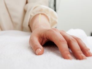 倪師針灸減肥的穴位