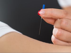 倪師針灸減肥的穴位