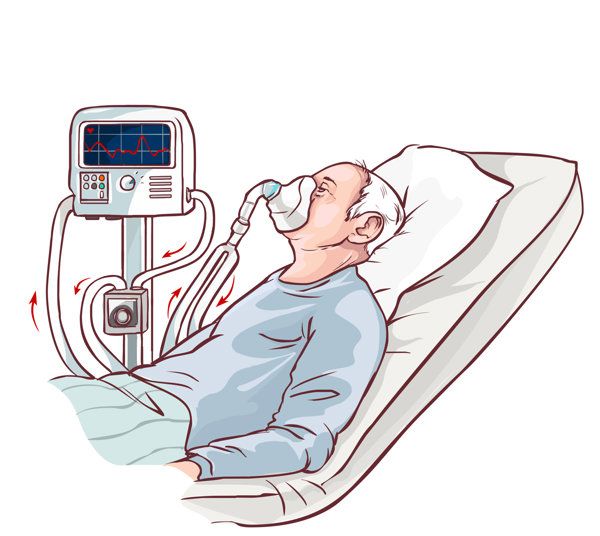 新生兒高頻振蕩呼吸機原理