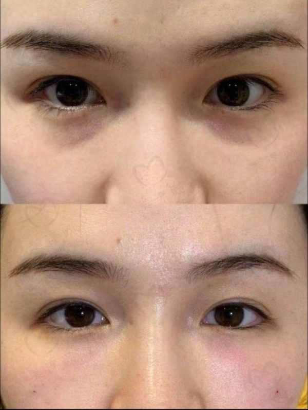 南昌春语医疗美容门诊部特色项目及技术优势