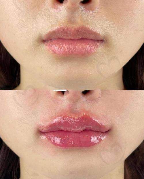 南昌春语医疗美容门诊部收费价格表/收费标准