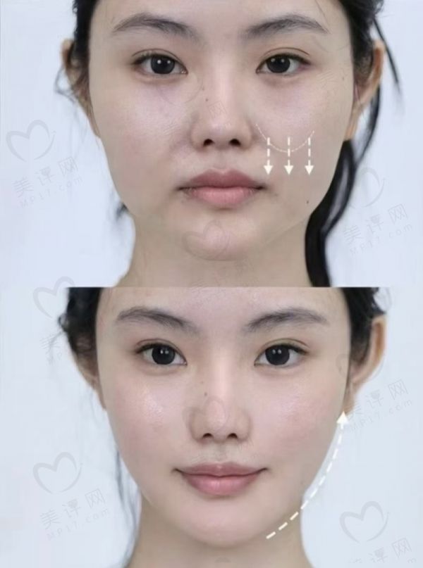 南昌春语医疗美容门诊部真人口碑评价怎么样？