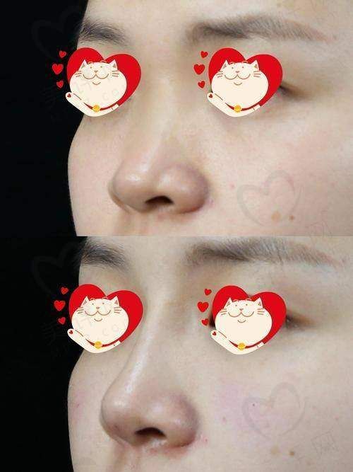 南昌春语医疗美容门诊部详细的预约挂号方式及流程