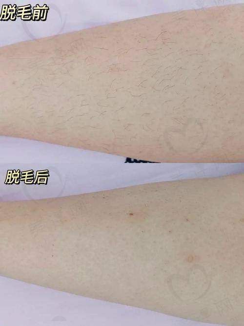 南昌春语医疗美容门诊部地址电话营业时间