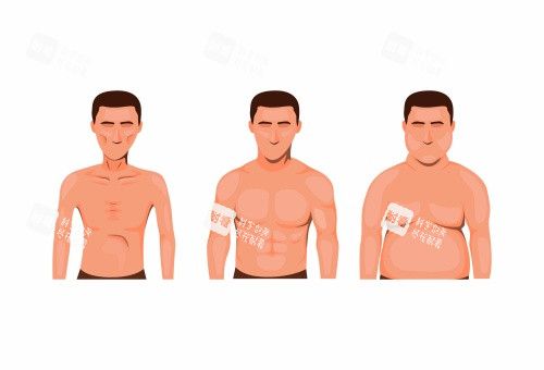 男性乳房发育吸脂后图片示意图