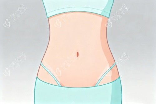 腰腹部做吸脂塑形卡通图