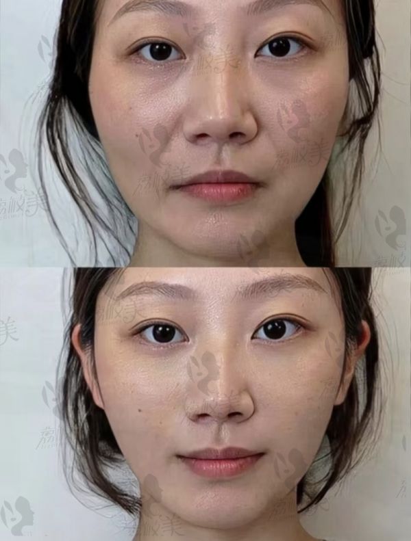 五、选择方法要考虑这些因素