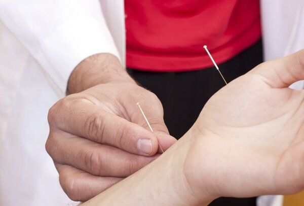 节食期间可以针灸吗