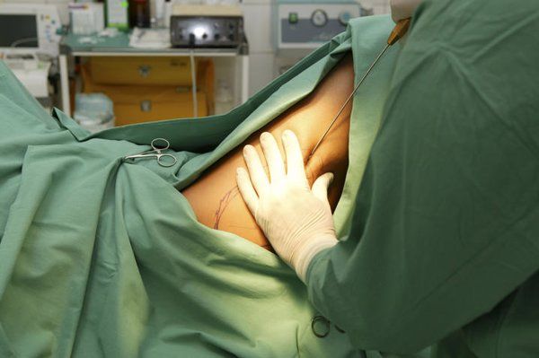 脸部轮廓不好看怎么办