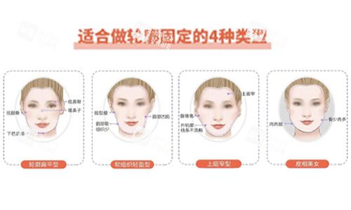 面部轮廓固定适合类型
