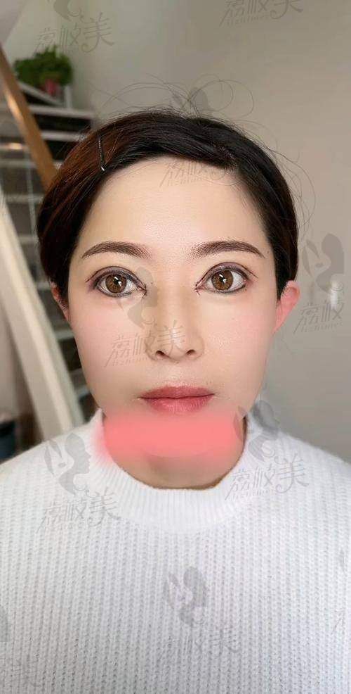 江油白天鹅整形医院正规吗？看资质